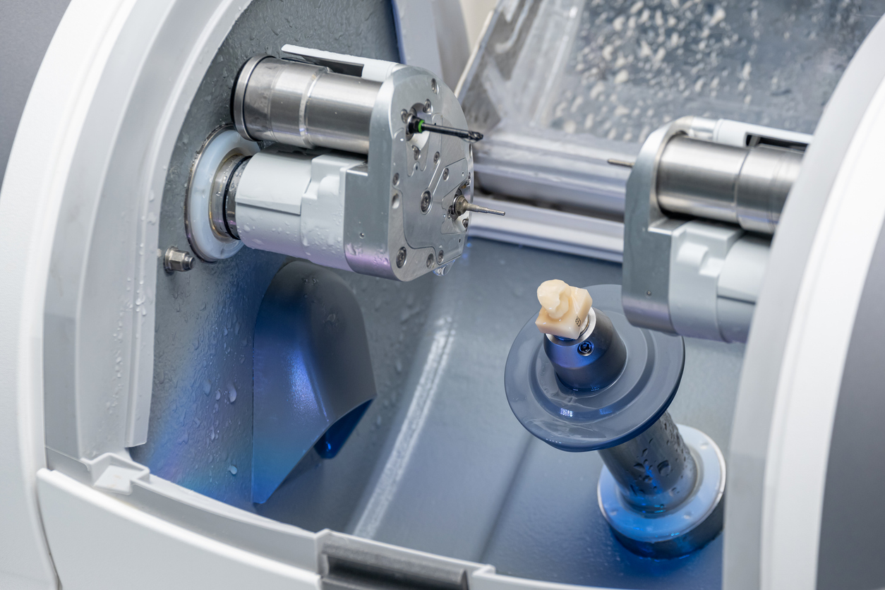 CEREC Same-Day Crowns in Wisconsin