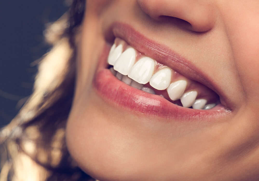 Cosmetic Dentistry Services in Dousman: teeth whitening veneers crowns